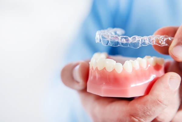 Invisalign Available near London, Ontario 